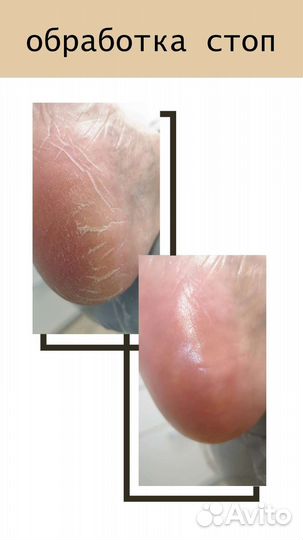 Маникюр, педикюр, подолог, косметолог,перманент