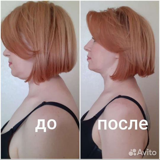 Массаж живота, Правка живота или Висцеральная прак