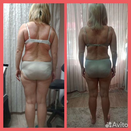 LPG массаж на Воронежской