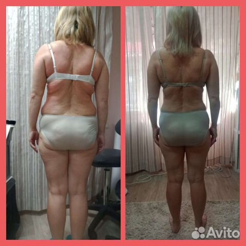 LPG массаж на Воронежской