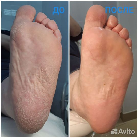 Услуги подолога