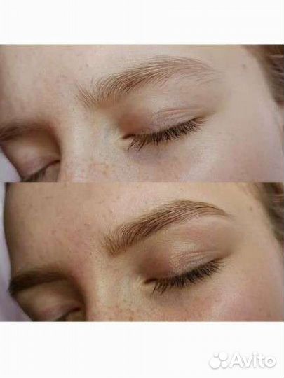 Депиляция,буккальный массаж лиц,чистка лица,брови