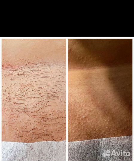 Модель на шугаринг