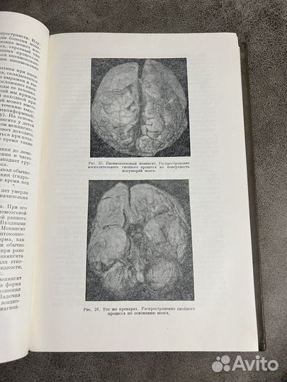 Заболевания нервной системы у детей, Футер