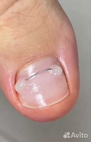 Услуги подолога