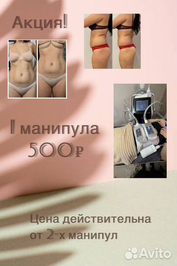 Криолиполиз