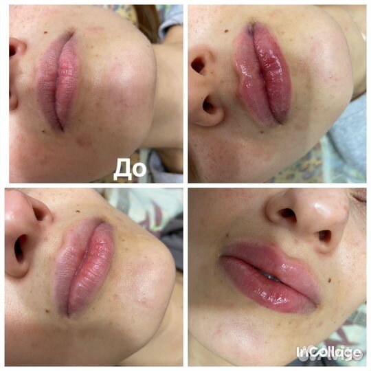 Услуги косметолога массажи инъекции чистка лица