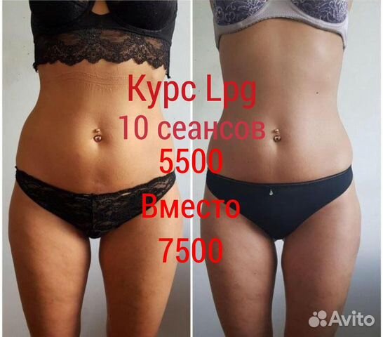 Требуются модели по коррекции фигуры и похудению