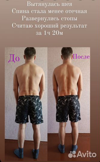 Лимфатический массаж