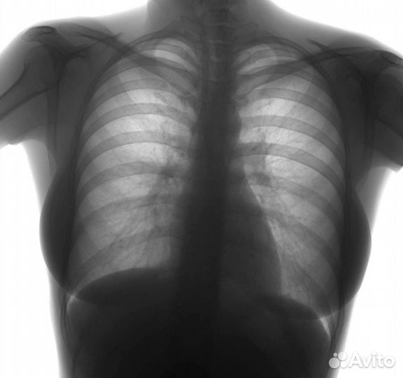 Слушатель. Собеседник. Друг на час