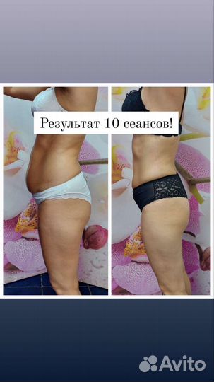 Коррекция фигуры
