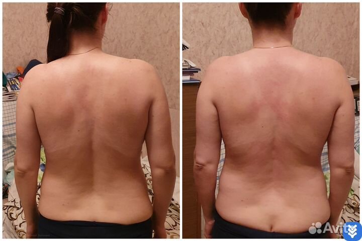 Массаж мануальный Остеопат / Костоправ