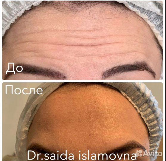 Врач косметолог