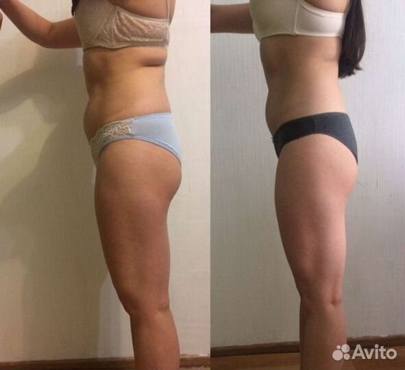 Массаж ручной/аппаратный (женщины и мужчины)