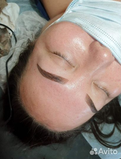 Удаление татуажа ремувером. Пудровое напыление губ