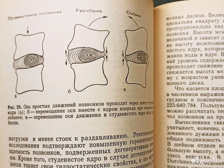 Крестцовые боли. Дзяк. 1981