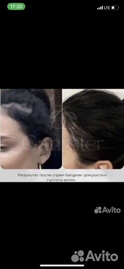 Спрей от выпадения волос