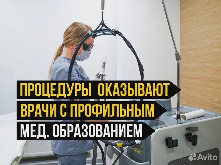 Лазерная эпиляция