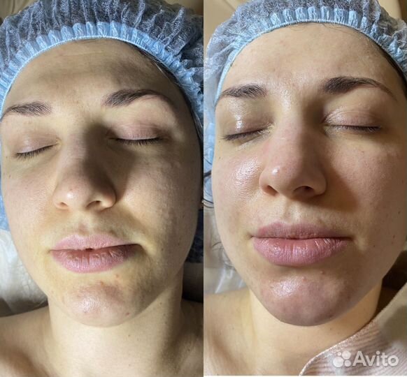 Массаж лица/микротоки/чистка лица