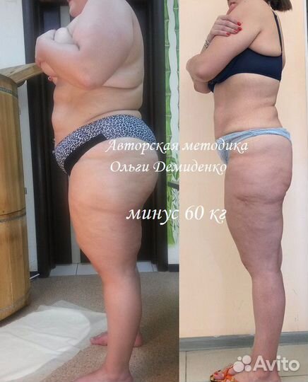 Коррекция фигуры в Москве