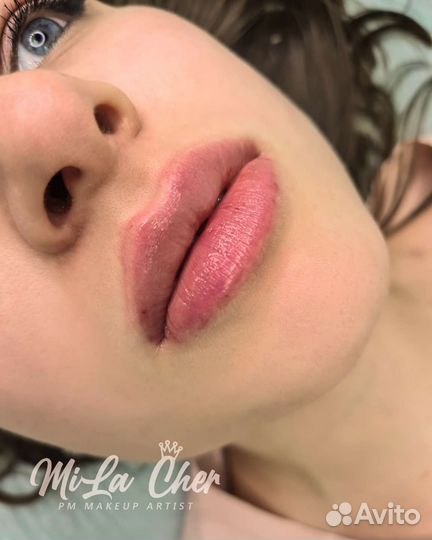 Увеличение губ