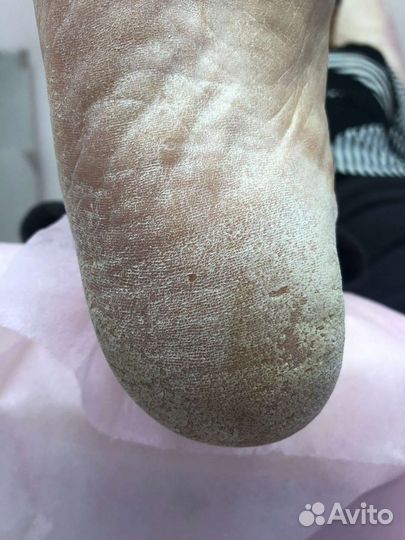 Педикюр, маникюр