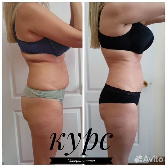 Аппаратная коррекция фигуры