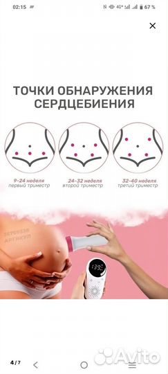 Допплер сердцебиения плода