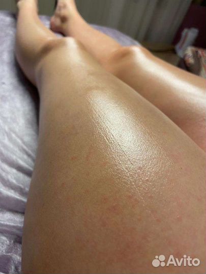 Шугаринг: руки выше локтя