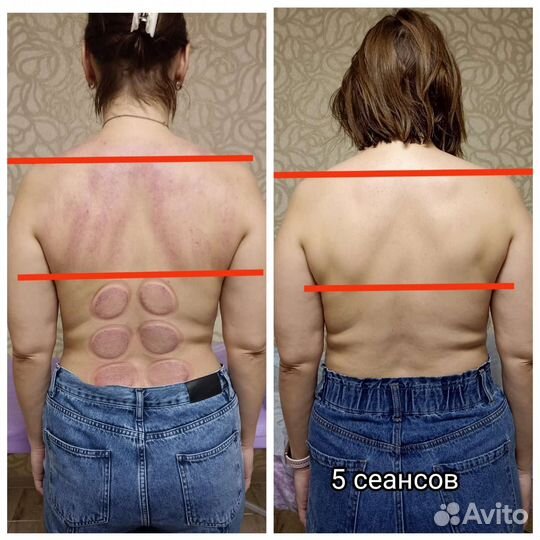 Массаж взрослым и детям