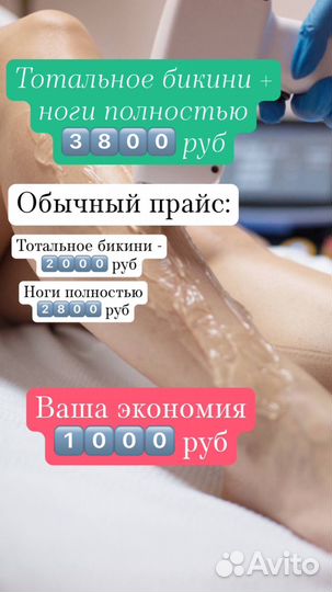 Лазерная эпиляция