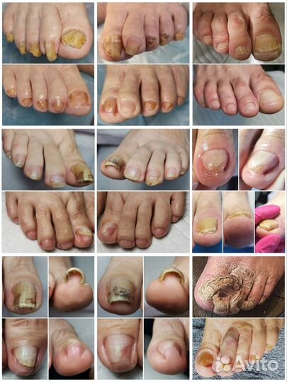 Подолог/Педикюр/Маникюр