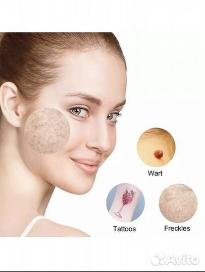 Лазерная ручка для удаление