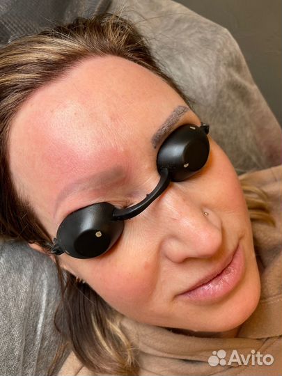 Удаление тату удаление тутажа лазером