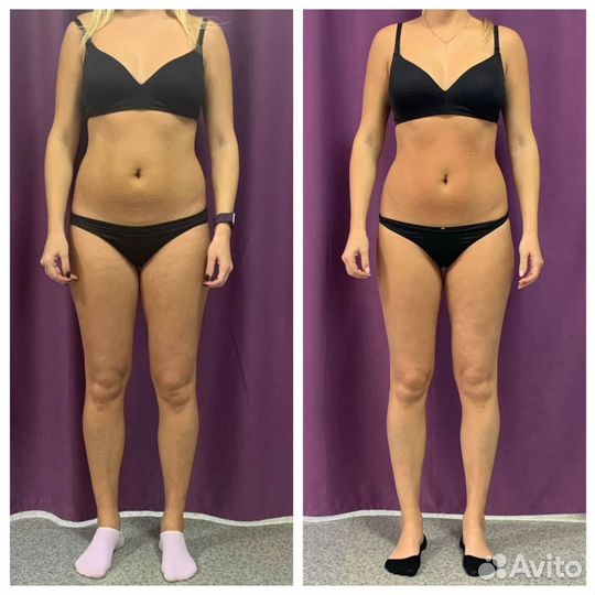 Аппаратный массаж тела