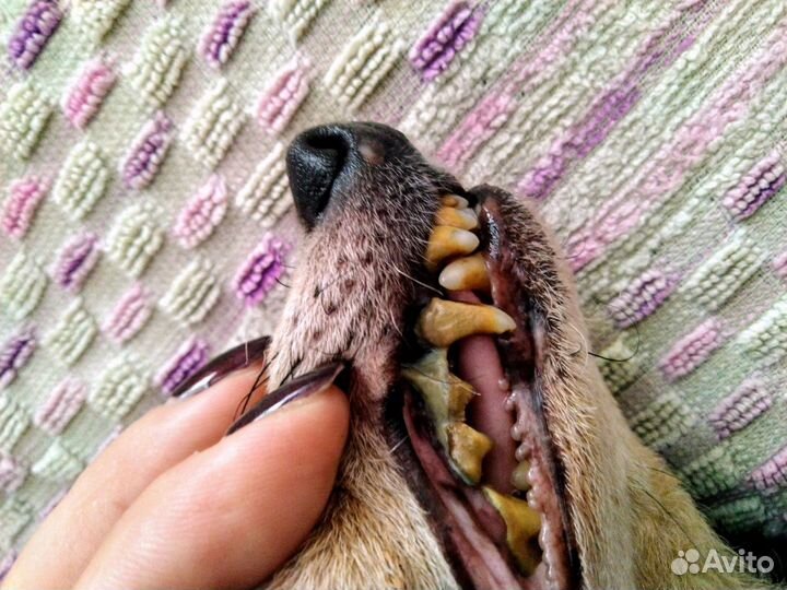 Ультразвуковая чистка зубов без стресса