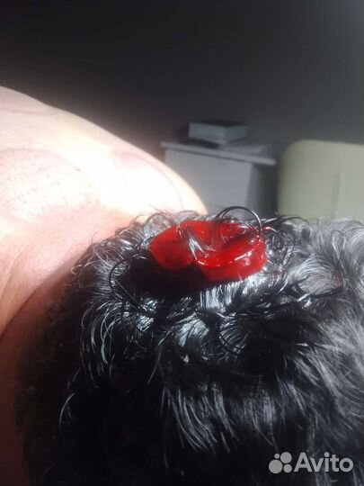 Спортивный массажист змс Чистки спины лица