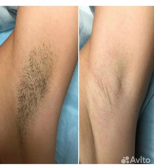 Модель на шугаринг