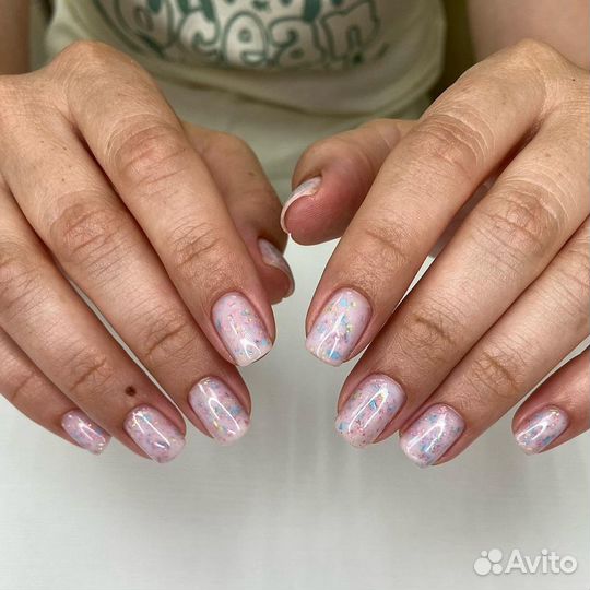 Подолг в Солнцево. Проблемные ногти и пятки