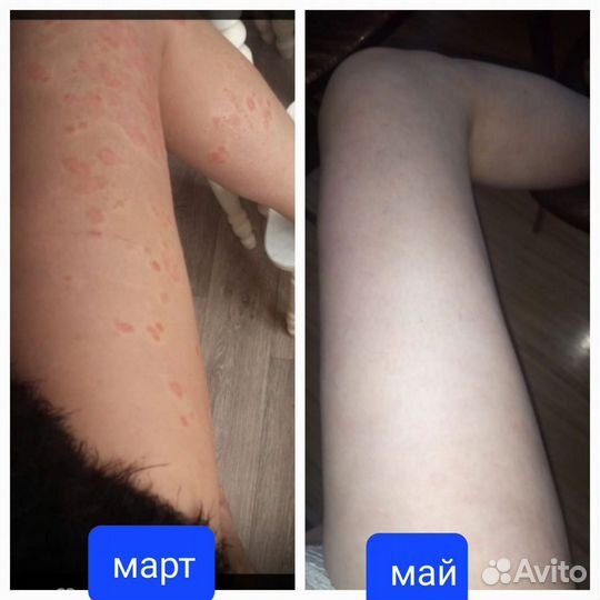 HemoHim иммунитет