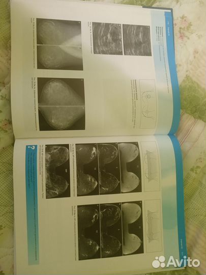 Книги по медицине, рентгенология