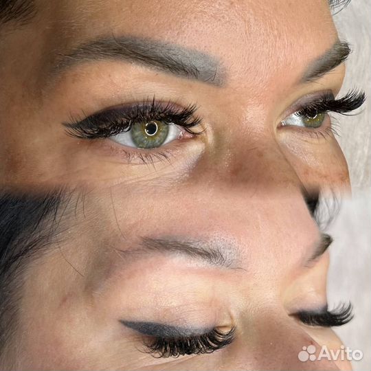 Лазерное удаление тату