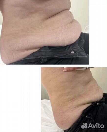 Услуги косметолога