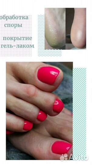 Наращивание ногтей. Маникю