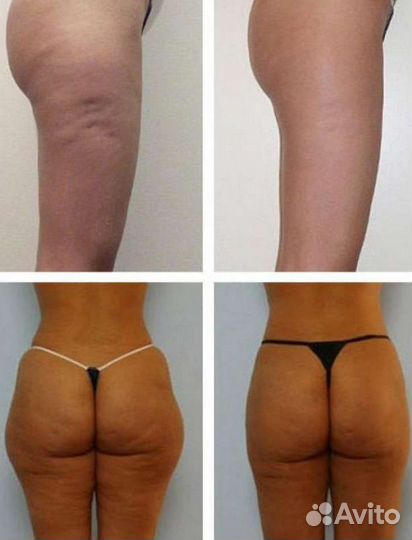 Массаж, спа