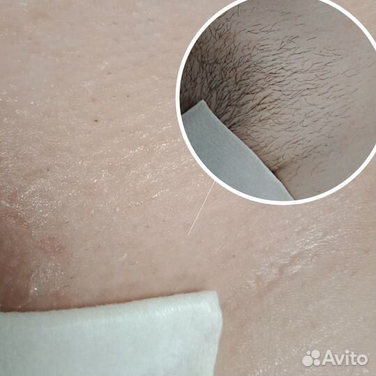 Эпиляция воском и шугаринг