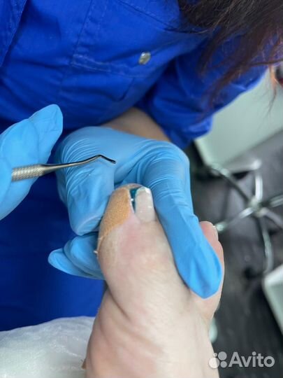 Подолог, подологический педикюр