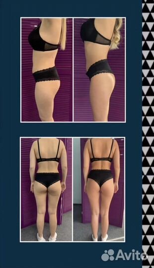 Массаж Vela Shape (LPG) 4 зоны 40 минут