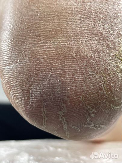 Ищем модель с проблемными ногами