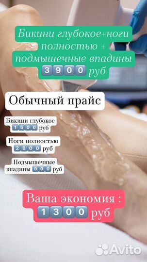 Лазерная эпиляция